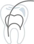 endodoncia en la clínica dental en Terrassa