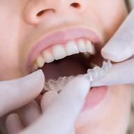 ortodoncia avanzada en clínica dental en terrassa