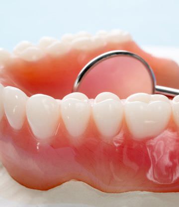 tratamienos de prótesis dental en terrassa